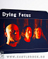    dying fetus ()